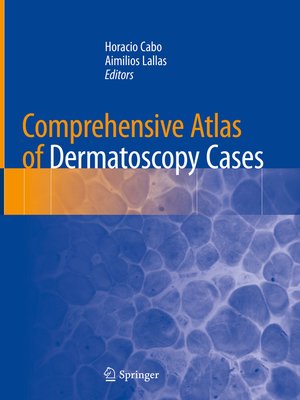 cover image of Comprehensive Atlas of Dermatoscopy Cases